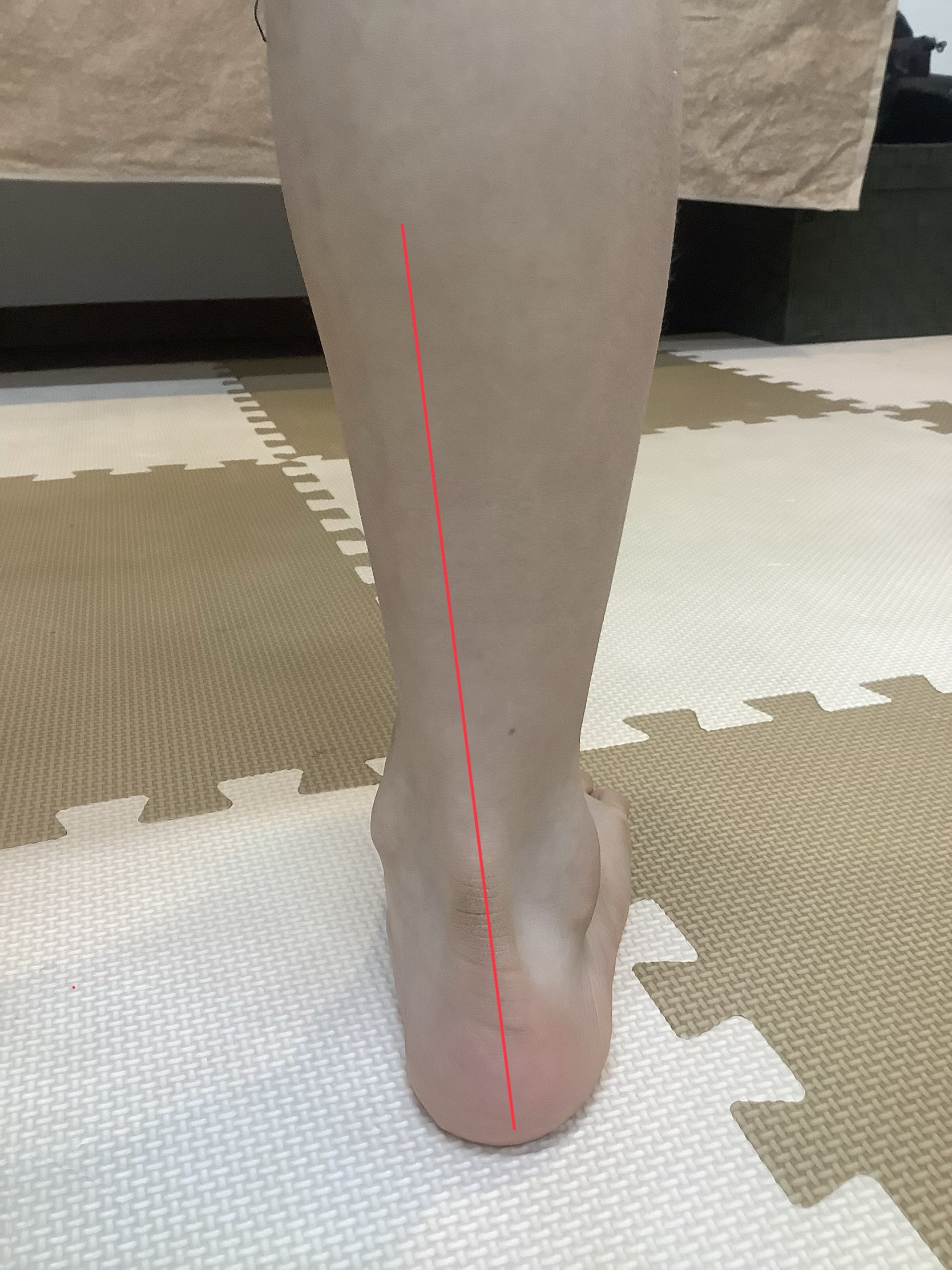 裸足で足首の軸が内側に崩れた状態